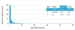 FABP5/E-FABP, Mouse anti-Human, Clone: FABP5/3750, Novus Biologicals:Antibodies:Primary